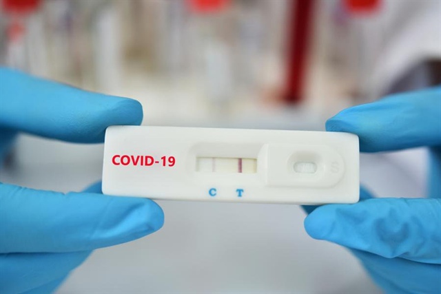 Vạch kit test Covid-19 lúc mờ lúc đậm ảnh 2