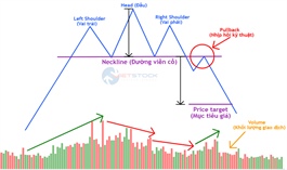 Kinh nghiệm đầu tư năm 2026 (Kỳ 3): Head & Shoulders – Chốt chặn bảo vệ thành quả của bạn!
